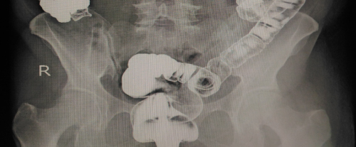 Image hover effect image