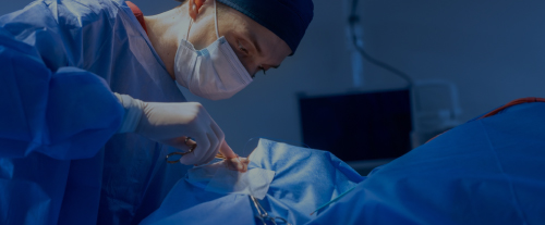 Image hover effect image